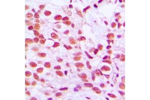 Immunohistochemistry (IHC) image for anti-ELK1, Member of ETS Oncogene Family (ELK1) (C-Term), (pSer389) antibody (ABIN7295584)
