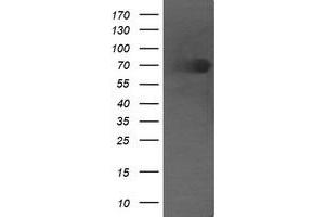 Image no. 1 for anti-Differentially Expressed in FDCP 6 Homolog (DEF6) antibody (ABIN1497811) (DEF6 抗体)