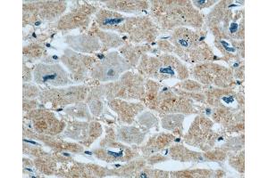 Immunohistochemistry (IHC) image for anti-Xin Actin-Binding Repeat Containing 2 (XIRP2) antibody (ABIN2906145) (XIRP2 抗体)