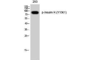 Western Blotting (WB) image for anti-Insulin Receptor (INSR) (pTyr1361) antibody (ABIN3182542) (Insulin Receptor 抗体  (pTyr1361))