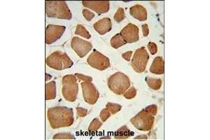 Formalin-fixed and paraffin-embedded human skeletal muscle reacted with ANGPTL4 Antibody (Center), which was peroxidase-conjugated to the secondary antibody, followed by DAB staining. (ANGPTL4 抗体  (AA 138-167))
