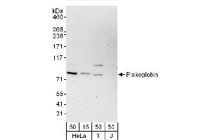 Western Blotting (WB) image for anti-Junction Plakoglobin (JUP) (AA 1-50) antibody (ABIN7453165)