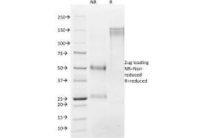 SDS-PAGE (SDS) image for anti-Histone H1 antibody (ABIN6939594)