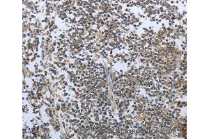 Immunohistochemistry of Human tonsil using PRL Polyclonal Antibody at dilution of 1:30 (Prolactin 抗体)