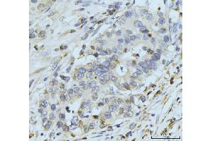 IHC analysis of GP210/NUP210 using anti-GP210/NUP210 antibody (ABIN7600707). (NUP210 抗体  (AA 221-1724))