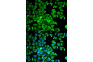 Immunofluorescence analysis of U2OS cells using TCP1 antibody. (TCP1 alpha/CCTA 抗体  (AA 307-556))