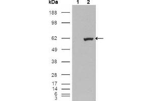 Western blot analysis using ETV1 mouse mAb against HEK293T cells transfected with the pCMV6-ENTRY control (1) and pCMV6-ENTRY ETV1 cDNA (2). (ETV1 抗体)