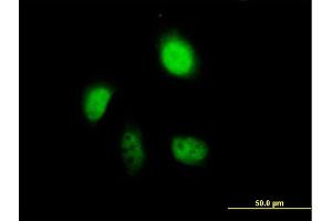 Immunofluorescence of purified MaxPab antibody to ANXA7 on HeLa cell. (Annexin VII 抗体  (AA 1-466))