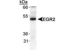 Western blot analysis of EGR2 in human fetal lung tissue using EGR2 polyclonal antibody . (EGR2 抗体  (AA 200-300))