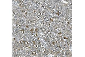 IHC analysis of SCG10/STMN2 using anti-SCG10/STMN2 antibody (ABIN7600734).