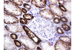Image no. 1 for anti-Carbonic Anhydrase 12 (CA12) antibody (ABIN1497068) (CA12 抗体)