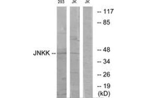 Western blot analysis of extracts from 293/Jurkat cells, using JNKK Antibody. (MAP2K4 抗体  (AA 316-365))