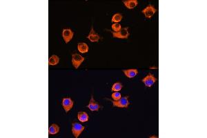 Immunofluorescence analysis of L929 cells using MFI2 Rabbit pAb (ABIN6131379, ABIN6143795, ABIN6143796 and ABIN6222350) at dilution of 1:100 (40x lens). (MFI2 抗体  (AA 20-200))