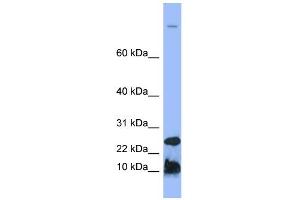 WB Suggested Anti-HAMP Antibody Titration:  0. (Hepcidin 抗体  (N-Term))