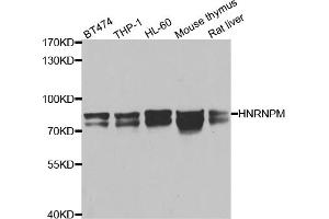 Western blot analysis of extracts of various cell lines, using HNRNPM antibody (ABIN5975447) at 1/1000 dilution. (HNRNPM 抗体)