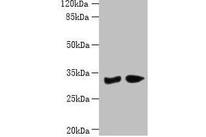 Western blot All lanes: PBLD antibody at 6 μg/mL Lane 1: Mouse liver tissue Lane 2: Mouse kidney tissue Secondary Goat polyclonal to rabbit IgG at 1/10000 dilution Predicted band size: 32 kDa Observed band size: 32 kDa (PBLD1 抗体  (AA 11-288))