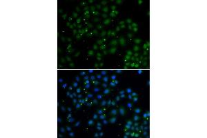 Immunofluorescence analysis of A549 cell using U2AF1L4 antibody.