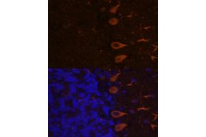 Immunofluorescence analysis of rat brain using K antibody (ABIN7268068) at dilution of 1:100.