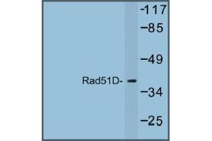 Image no. 1 for anti-RAD51 Homolog D (RAD51D) antibody (ABIN317685) (RAD51D 抗体)