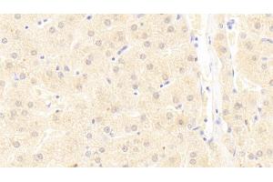 Detection of UBAP2 in Human Liver Tissue using Polyclonal Antibody to Ubiquitin Associated Protein 2 (UBAP2) (UBAP2 抗体  (AA 1-104))