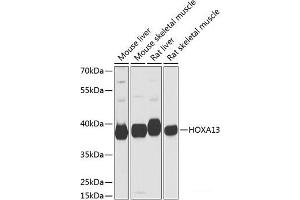 HOXA13 抗体