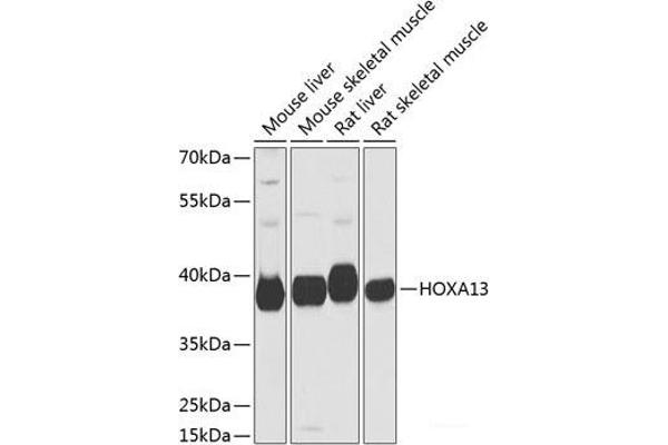 HOXA13 抗体