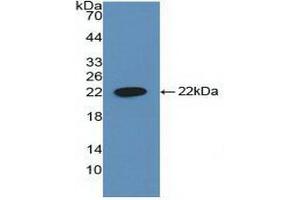 Detection of Recombinant CYFRA21-1, Human using Polyclonal Antibody to Cytokeratin Fragment Antigen 21-1 (CYFRA21-1) (CYFRA21.1 抗体  (AA 244-400))