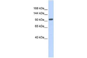 Western Blotting (WB) image for anti-Zinc Finger Protein 512B (ZNF512B) antibody (ABIN2458007) (ZNF512B 抗体)