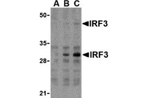 Western Blotting (WB) image for anti-Interferon Regulatory Factor 3 (IRF3) (Middle Region) antibody (ABIN1030963) (IRF3 抗体  (Middle Region))