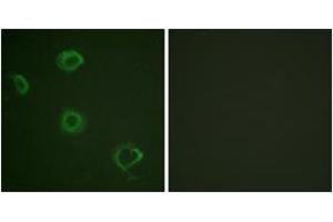 Immunofluorescence analysis of A549 cells, using Interferon-gamma Receptor alpha (Phospho-Tyr457) Antibody. (IFNGR1 抗体  (pTyr457))