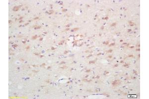 Formalin-fixed and paraffin embedded rat brain labeled with Rabbit Anti Ninein/GSK3B interacting protein Polyclonal Antibody, Unconjugated (ABIN872552) at 1:200 followed by conjugation to the secondary antibody and DAB staining (GSKIP 抗体  (AA 133-230))