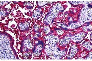 Human Placenta: Formalin-Fixed, Paraffin-Embedded (FFPE) (Haptoglobin 抗体)