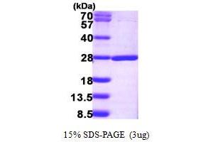 SDS-PAGE (SDS) image for Nudix (Nucleoside Diphosphate Linked Moiety X)-Type Motif 16-Like 1 (NUDT16L1) (AA 1-211) protein (His tag) (ABIN667880) (NUDT16L1 Protein (AA 1-211) (His tag))
