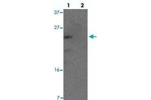 Western blot analysis of YPEL1 in HeLa cell lysate with YPEL1 polyclonal antibody  at 1 ug/mL in (lane 1) the absence and (lane 2) the presence of blocking peptide. (YPEL1 抗体  (N-Term))