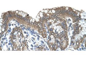 Human Stomach (RARRES3 抗体  (Middle Region))