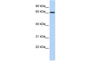 WB Suggested Anti-ZBTB7A Antibody Titration:  0. (ZBTB7A 抗体  (N-Term))