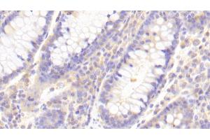 Detection of TLR8 in Human Colon Tissue using Polyclonal Antibody to Toll Like Receptor 8 (TLR8) (TLR8 抗体  (AA 844-1039))