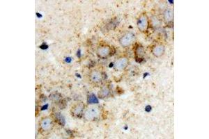 Immunohistochemical analysis of HARS2 staining in rat brain formalin fixed paraffin embedded tissue section. (HARS2 抗体)