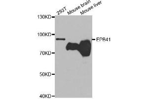 Western Blotting (WB) image for anti-Erythrocyte Membrane Protein Band 4.1 (Elliptocytosis 1, RH-Linked) (EPB41) antibody (ABIN1872554) (EPB41 抗体)