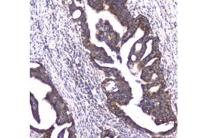 IHC analysis of CLPX using anti-CLPX antibody . (CLPX 抗体  (AA 337-574))