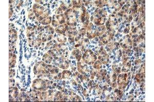 Immunohistochemical staining of paraffin-embedded Human pancreas tissue using anti-TBC1D21 mouse monoclonal antibody. (TBC1D21 抗体)