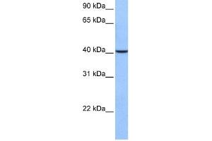 WB Suggested Anti-AGBL5 Antibody Titration: 0. (AGBL5 抗体  (C-Term))