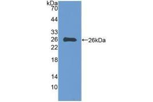 Detection of Recombinant EBI3, Human using Polyclonal Antibody to Epstein Barr Virus Induced Protein 3 (EBI3) (EBI3 抗体  (AA 21-229))