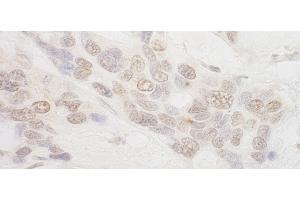 anti-Aquarius Homolog (AQR) (AA 1435-1485) antibody