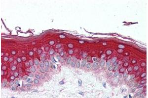 Human Skin (formalin-fixed, paraffin-embedded) stained with GBL antibody ABIN297122 at 10 ug/ml followed by biotinylated goat anti-rabbit IgG secondary antibody ABIN481713, alkaline phosphatase-streptavidin and chromogen. (GBL 抗体  (AA 150-200))