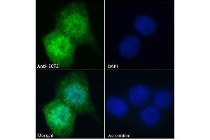 (ABIN185018) Immunofluorescence analysis of paraformaldehyde fixed A431 cells, permeabilized with 0. (ECT2 抗体  (N-Term))