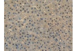 Detection of HSPA1A in Human Liver Tissue using Polyclonal Antibody to Heat Shock 70 kDa Protein 1A (HSPA1A) (HSP70 1A 抗体  (AA 1-641))