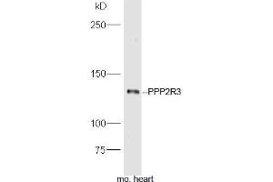 Western Blotting (WB) image for anti-Protein Phosphatase 2, Regulatory Subunit B'', alpha (PPP2R3A) (AA 801-900) antibody (ABIN714326)