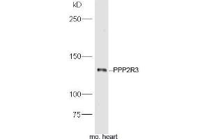 Mouse heart lysates probed with Rabbit Anti-PPP2R3 Polyclonal Antibody, Unconjugated  at 1:5000 for 90 min at 37˚C.