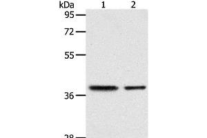 Western Blot analysis of Human fetal kidney and fetal muscle tissue using CNN3 Polyclonal Antibody at dilution of 1:400 (CNN3 抗体)